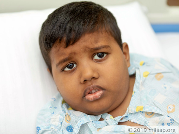 6-Year-Old Cancer Patient Prays To God To Not Separate Him From Mother