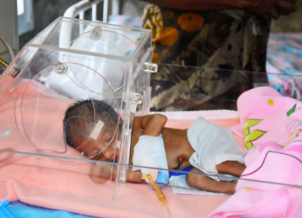 URGENT: 13 Days Old Baby Urgently Requires Heart Surgery (VSD)