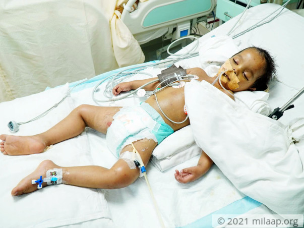Help Alex Verma Recover From Septic Shock