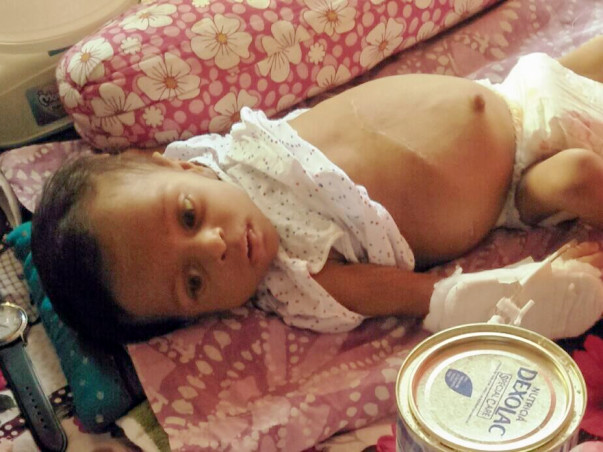Help 6-Month Samriddho Fight A Severe Liver Disease & Bloated Stomach