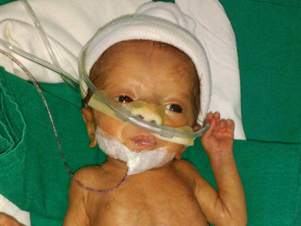 Help this Uber partner save his 7 month old pre-mature baby
