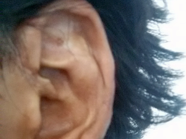 Help Mohd for Ear surgery