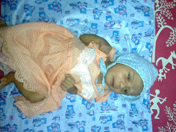 Help 4 Year Old Dnyanada Undergo Her Second Open Heart Surgery.