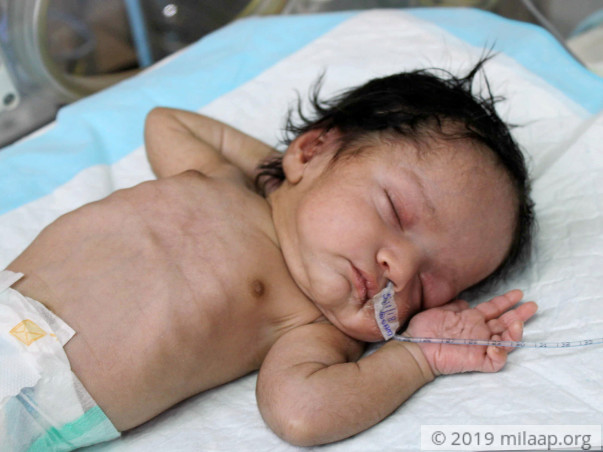 Mother Struggles To Save Baby Girl From A Rare And Deadly Disease