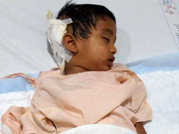 Toddler Gowrav Needs Your Help to Fight Brain Cancer