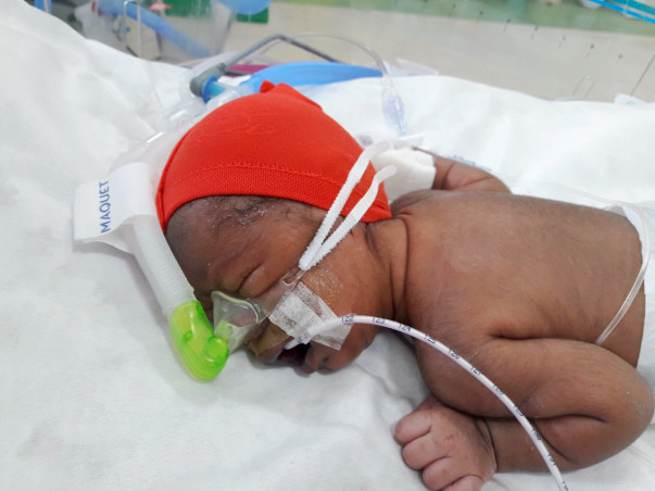 New Born Baby Needs Your Support To Live
