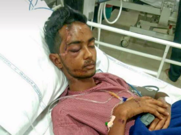 Need Money For A Friend's Skull fracture Operation