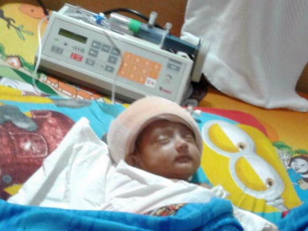 Help Baby Riddhi Fight Brain Operation