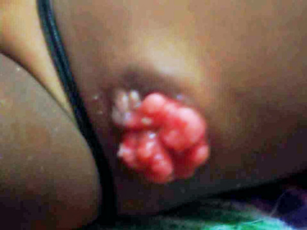 Chandran’s Babies Treatment