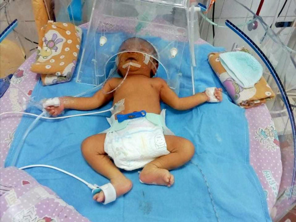 Premature Baby Needs Surgery In 24 Hours To Survive Kidney Damage