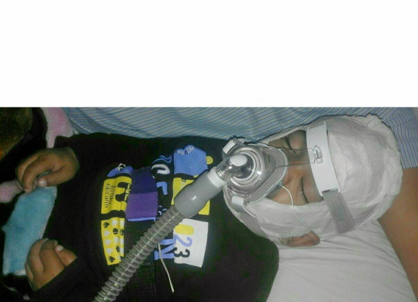 Save Little Shaurya, suffering from a rarest disease "Hunter Syndrome"