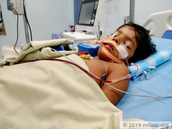 5-year-old Nivetha is fighting to stay alive after a Pneumonia attack
