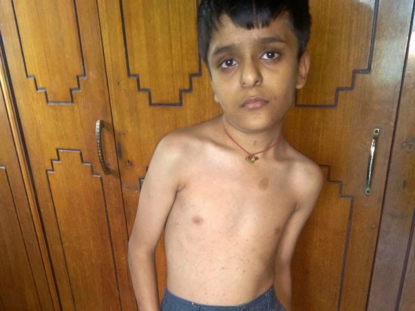 12 years old Lakshya Dugar needs your help .