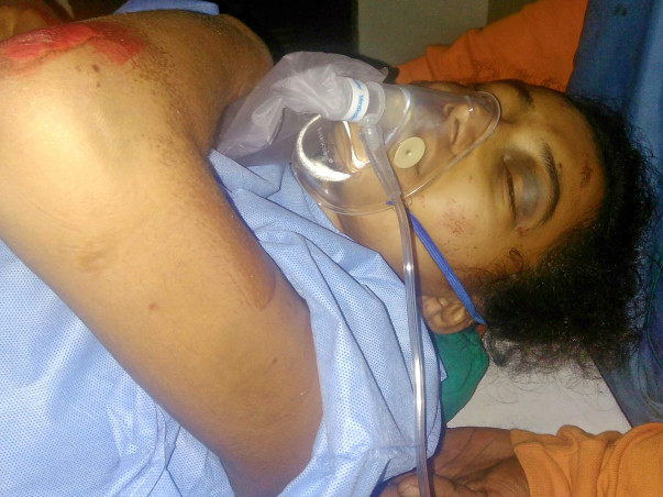 Help A Teenager Anusha Survive An Accident