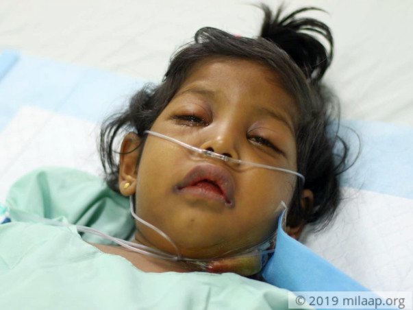 Help Little Safa Fight Acute Liver Failure And Undergo A Transplant