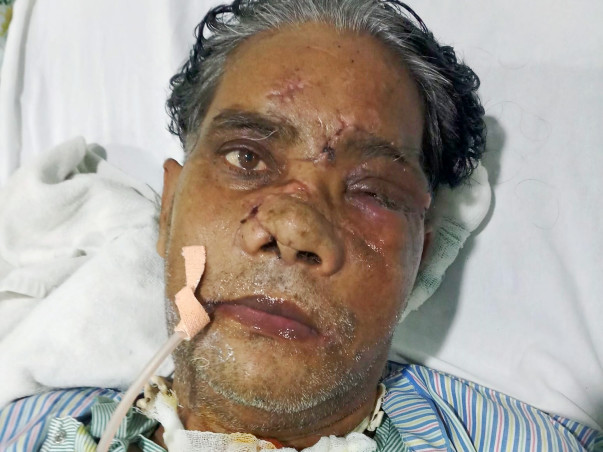 Please Help My father Undergo Eye And Throat Surgery