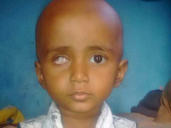 Help Divya Fight Eye Cancer