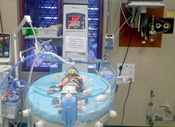 Urgent: Please save three months kid life