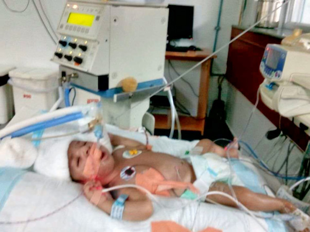 Help Baby of Chaya Fight a Lung Defect