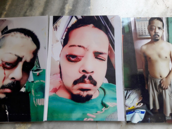 Help Mayank Fight Brain Tumor