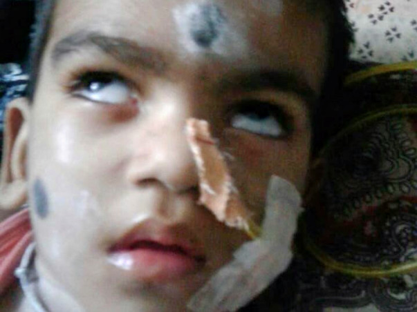 Help 3-Year-Old Sai Battles In The Hospital