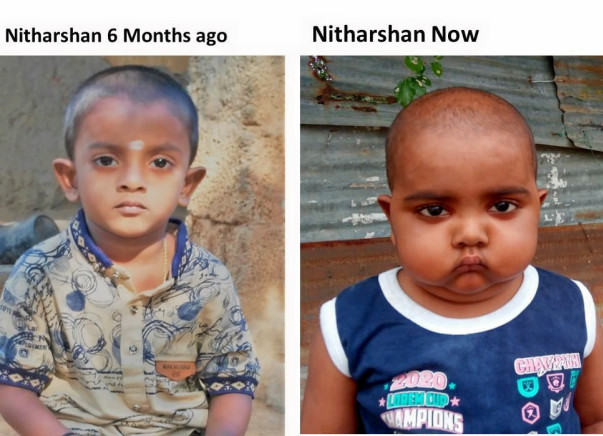 Nitharshan, A 4 yr old future doctor; support for Stem Cell Transplant