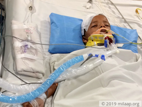 Kishore is gravely injured in an accident and is in ventilator.