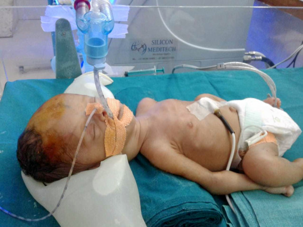 Help Nayanaben Save Her New Born Baby