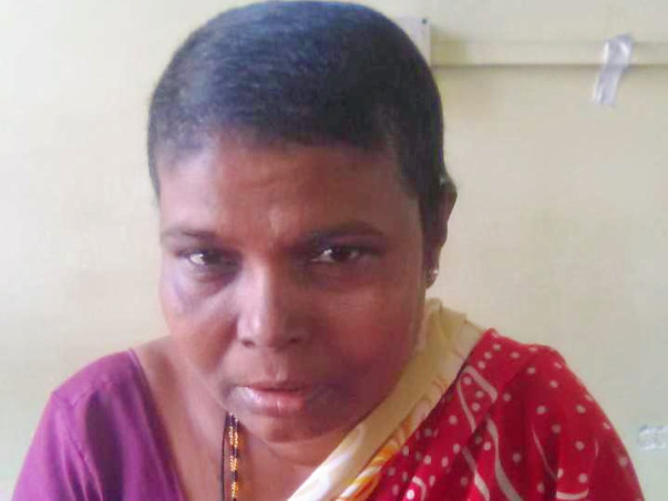Help My Mother Fight Cancer