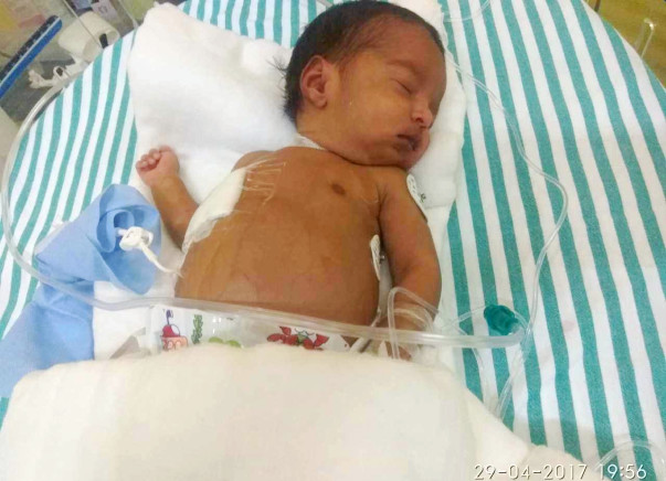 This Baby Developed Cancer A Week Before Her Birth