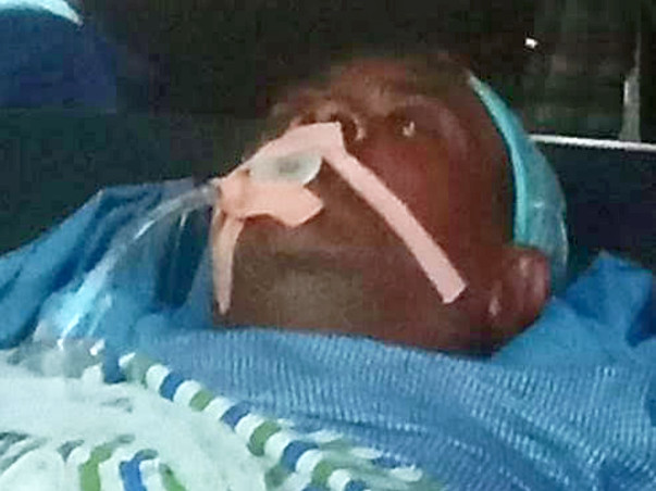 63 years old J.Asoph needs your help fight Road traffic accident with polytrauma