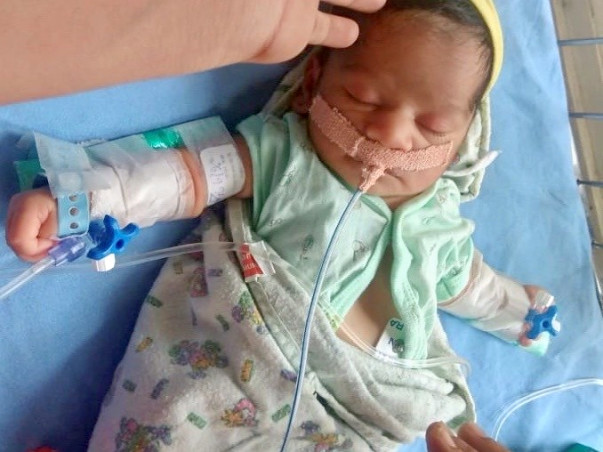 Help 9 Days Old, Rupali Ishwar From Suffering Heart Ailment