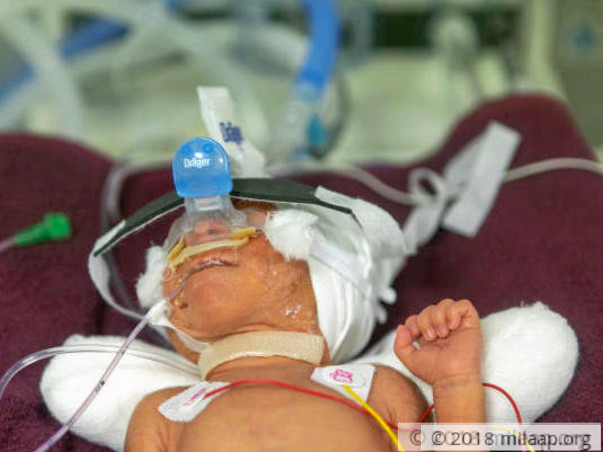 Help Srinivas and Eshwaramma save their new born baby boy