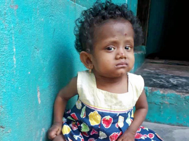 Help Baby Joshna Fight A Painful And Fatal Liver Disease
