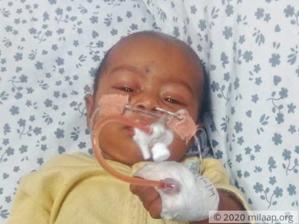 Help Amala's Baby Fight Infantile Dengue With Severe Pneumonia