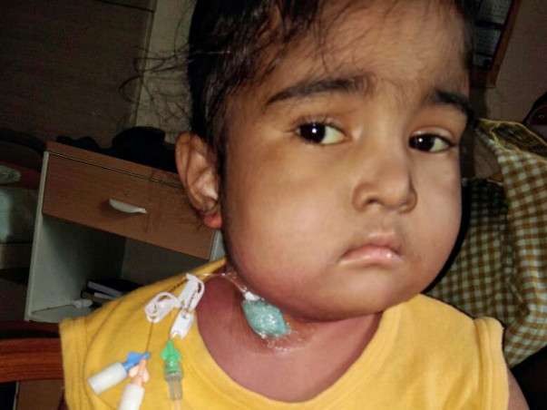Please Help Us In Saving 4 Year Old Baby Gayathri
