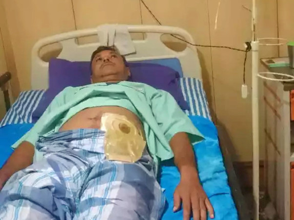 He Abdur Rashid Get A Liver Surgery.