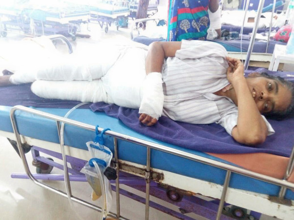 "Help Swarna fire accident" - She needs funds for medical expenses