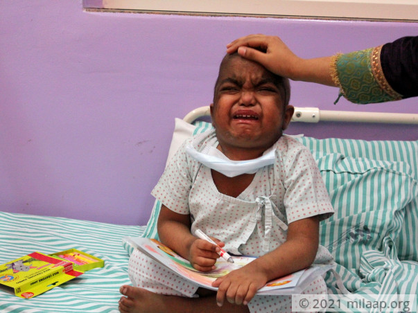 3-Year-Old’s Rare Disease Can Take Away His Sight And Life