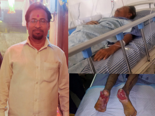 Help to raise fund for my father's both heels plastic surgery