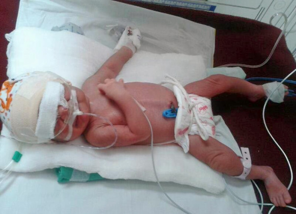 Please help my 1-week-old baby fighting for his life