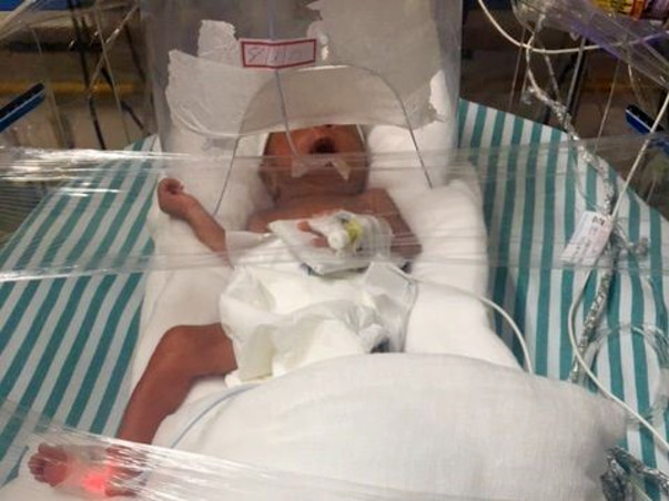 Help Baby Of Romana Parvin Get NICU Treatment