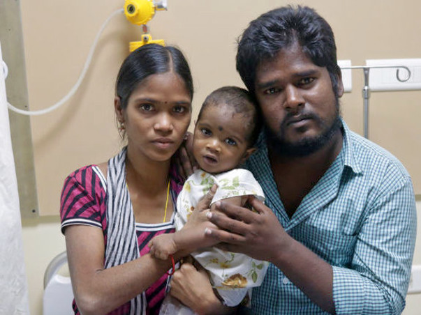 8 Months Baby Vignesh Suffering From Congenital Heart Disease