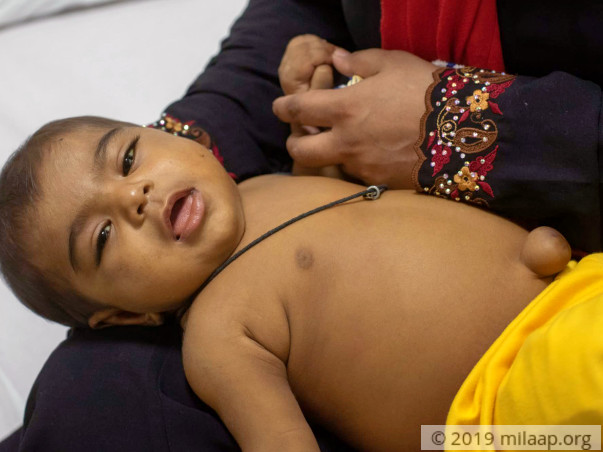 Misam Mohammed needs your help to undergo Liver Transplant