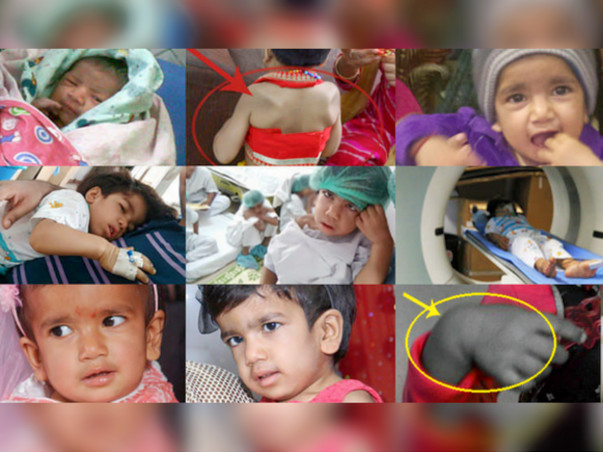 Help My Daughter Live #HelpSaveAvishi