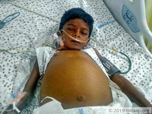 8-year-old Pawan Needs A Liver Transplant In Five Days To Live