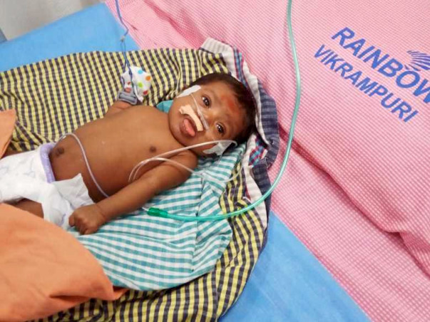 Save The 1-month-old Small Baby Recover From Lungs Complication