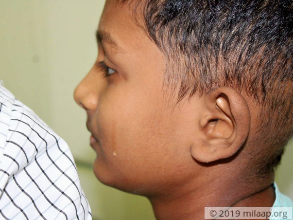 Santhosh needs your help!