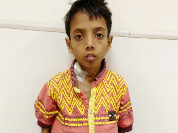 Help 9-year-old Vishi undergo a surgery to stay alive