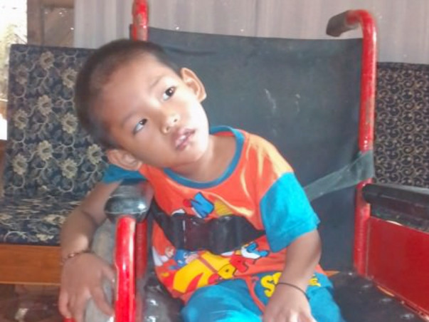 Plize help baby Alun .. As he needed stem cell therapy or bone marrow